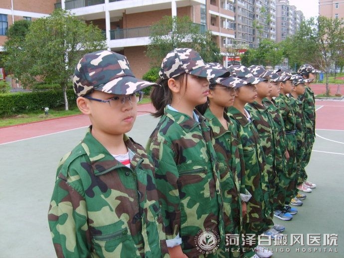 青少年(nian)白癜風軍訓
