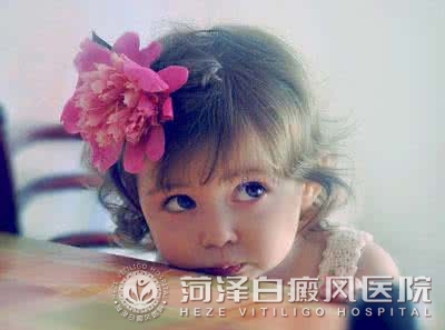 白癜風夏天