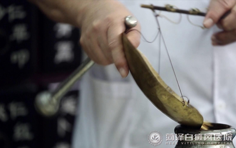 白癜風專(zhuan)科(ke)醫(yī)院山(shān)東