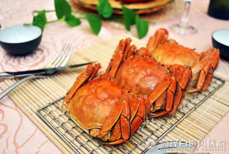 菏澤白癜風飲食螃蟹